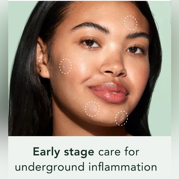 RAEL BEAUTY - 4 x Microcrystal Acne Healing Spot Cover - 4 Patches - Picture 5 of 9